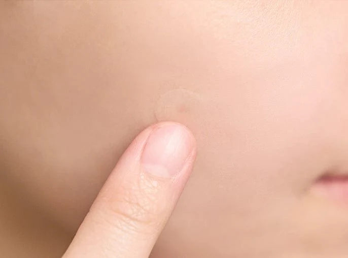 Tea-Trica Spot Cover Patch - SKIN1004