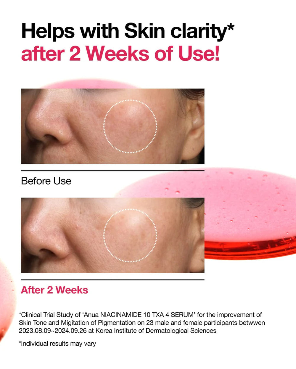 NIACINAMIDE 10%+TXA 4% Serum - Anua